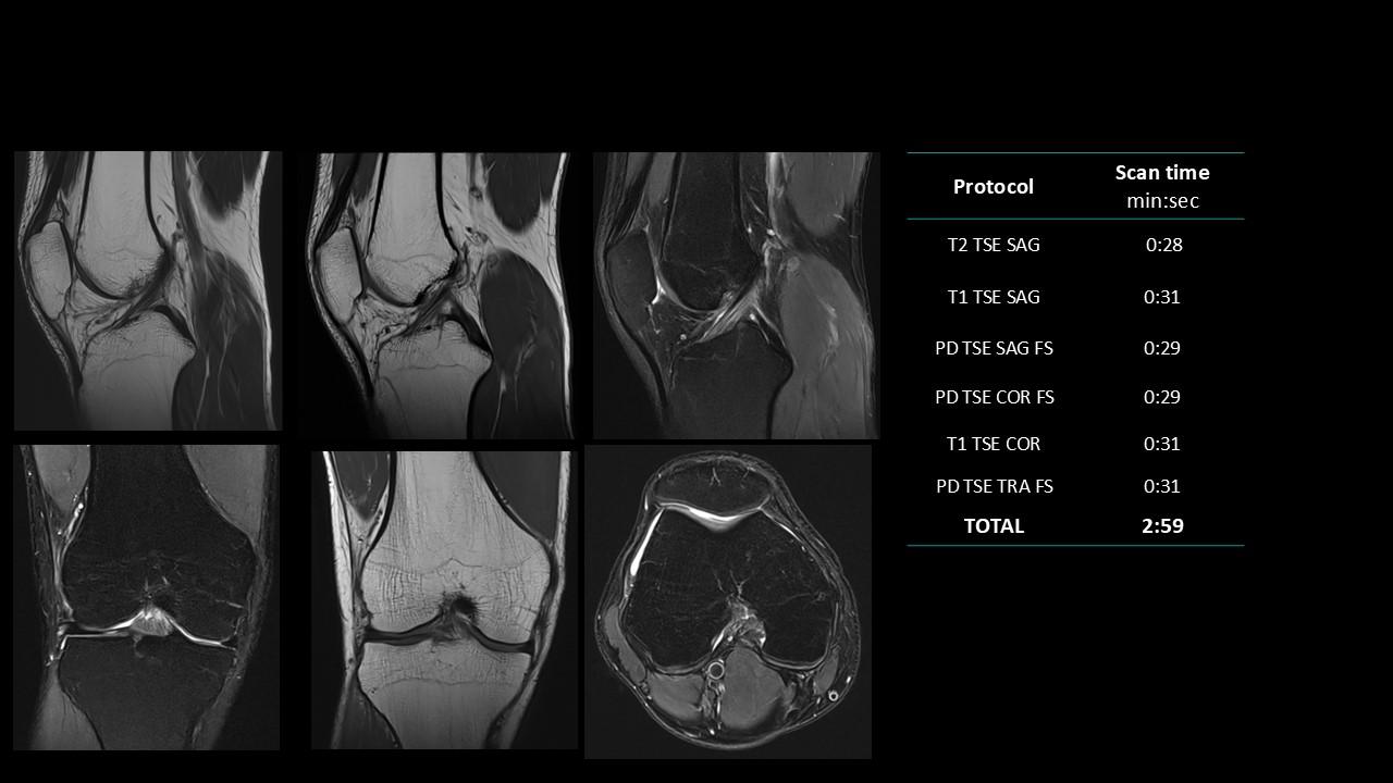 siemens-healthineers_magnetomworld_Knee-rountine
