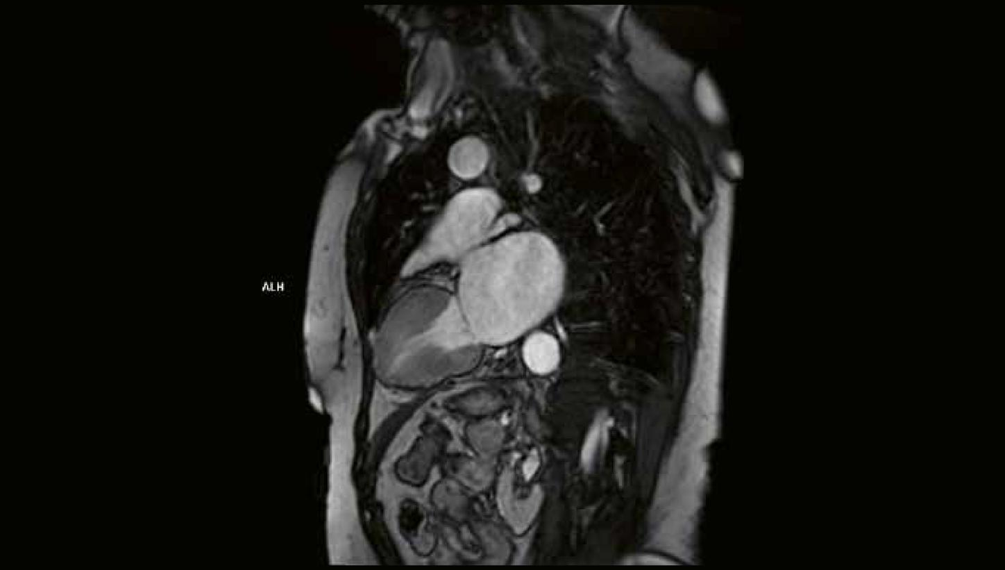Clinical case MRI Cardiology imaging 2026