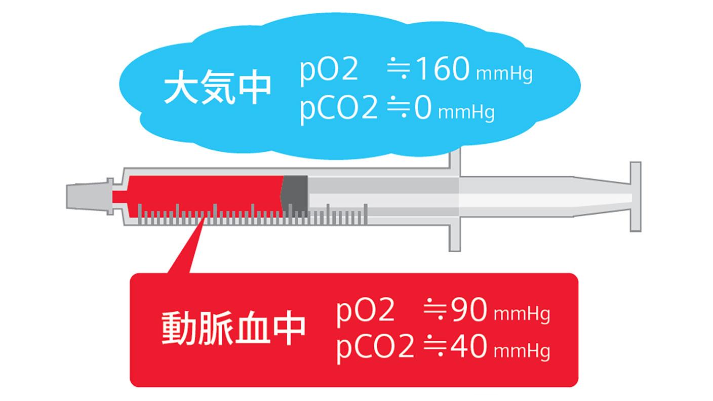 血液ガス分析かわら版②イラスト