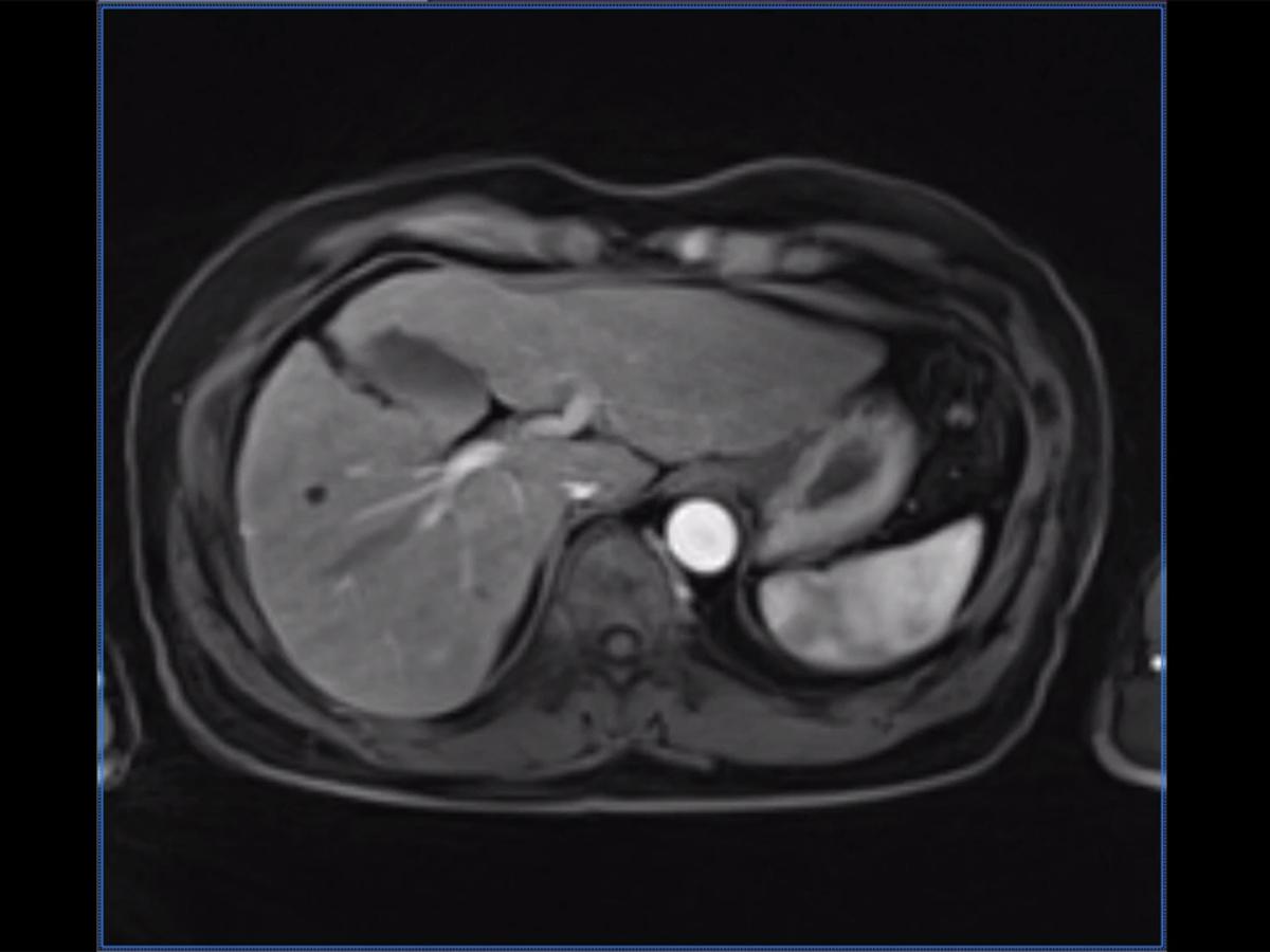 Body MRI - Siemens Healthineers Romania