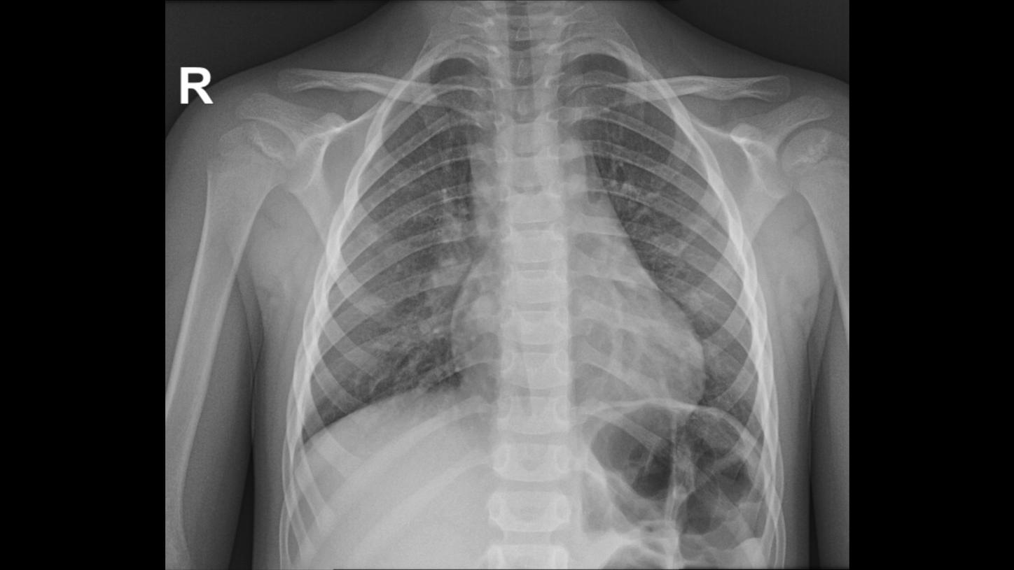 DI XP Luminos Qnamix Chest