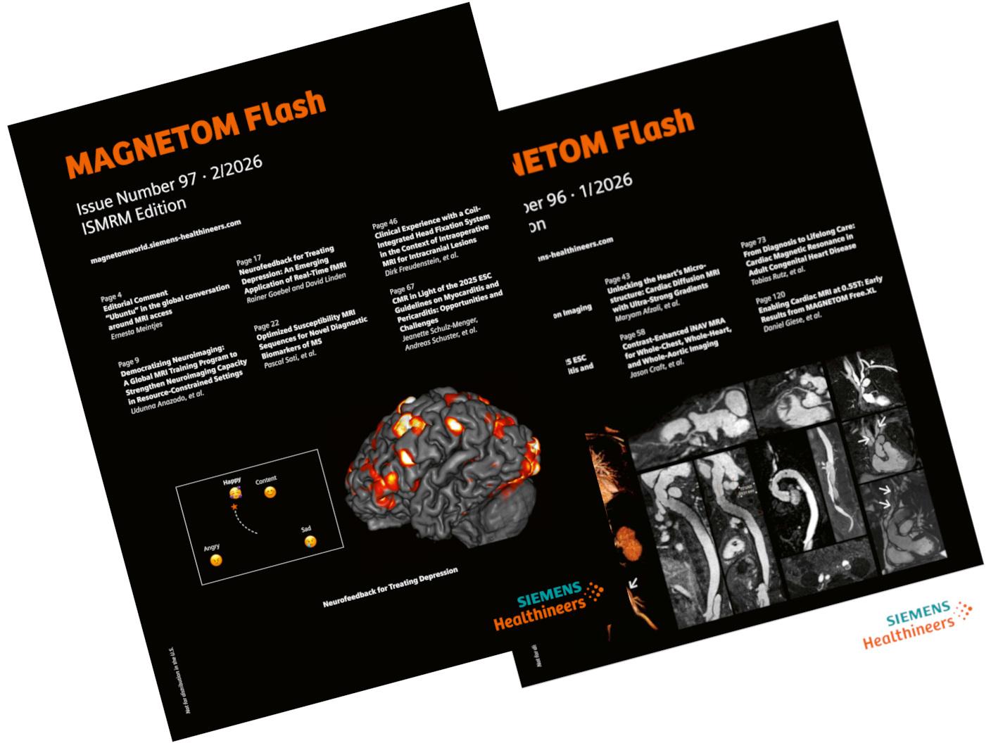MAGNETOM Flash<br /><br />