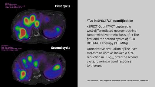 Moving SPECT/CT forward - Siemens Healthineers USA