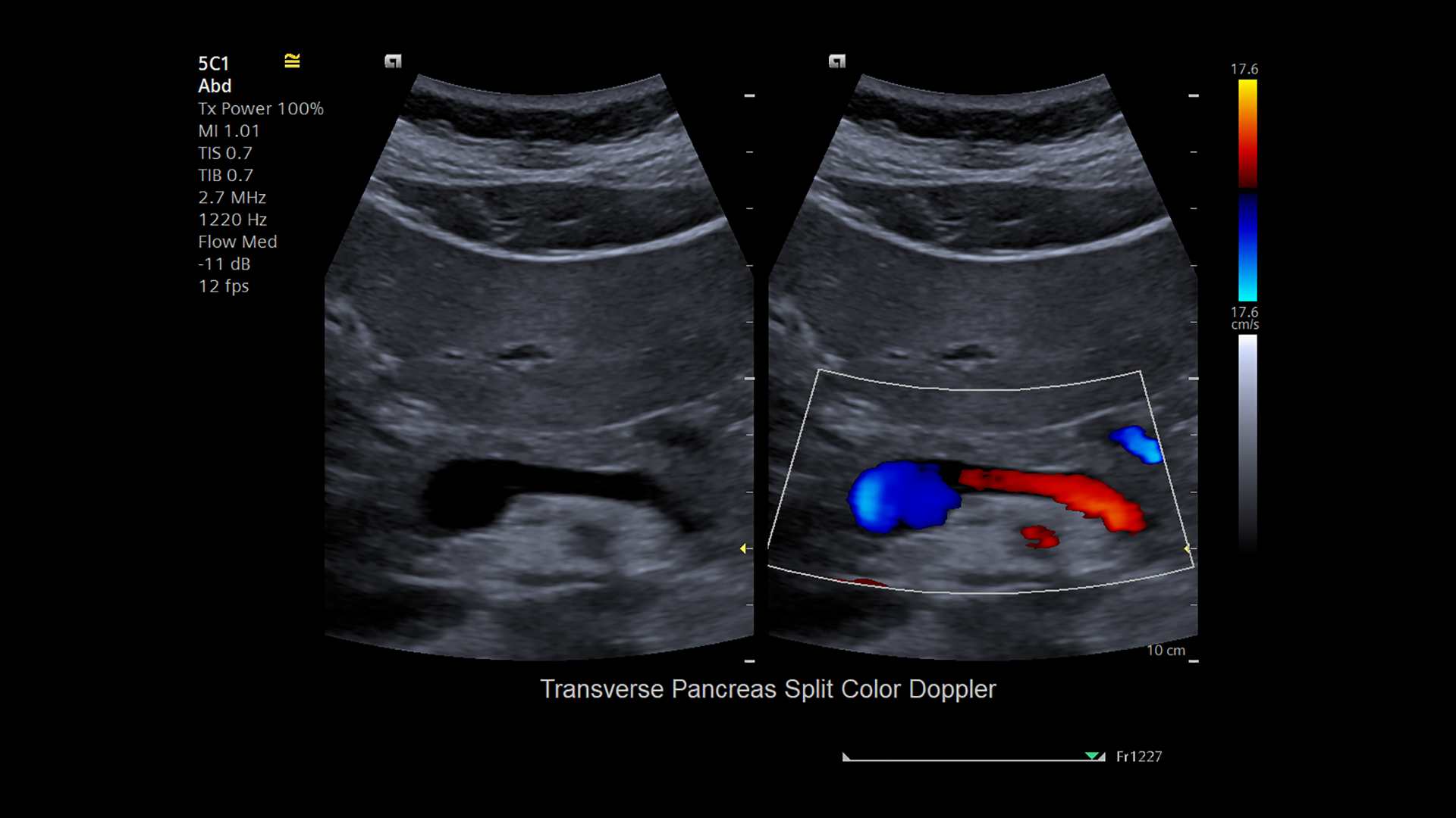 ACUSON Juniper is a HighPerformance Shared Service Ultrasound System. Siemens Healthineers USA