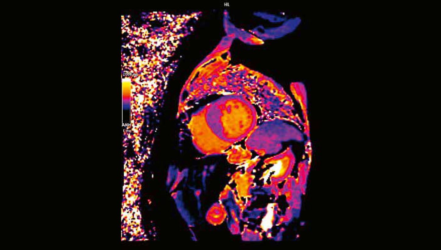 Clinical case MRI Cardiology CC2026