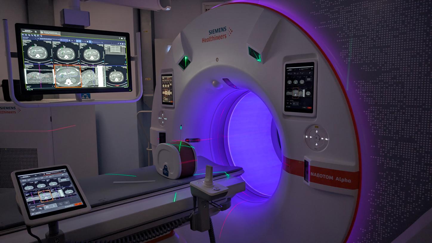 The newly installed NAEOTOM Alpha photon-counting CT scanner from Siemens Healthineers stands centre stage in the imaging suite at Nottingham University Hospitals NHS Trust. The advanced system is paired with myNeedle Companion, a laser guidance tool, which is visibly illuminated and ready for precision intervention. 