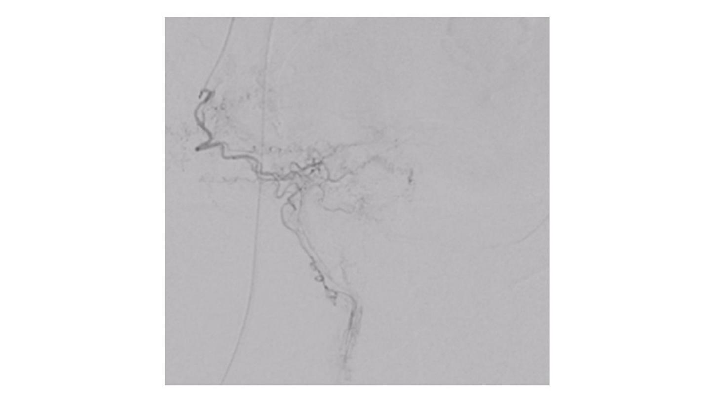 OPTIQ AI CNR-based exposure regulation image