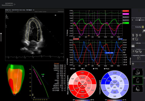 Strain Imaging Findings