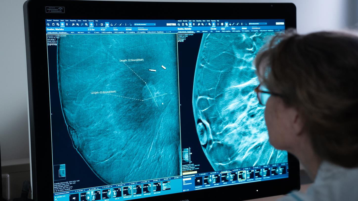 Contrast Enhanced Mammography