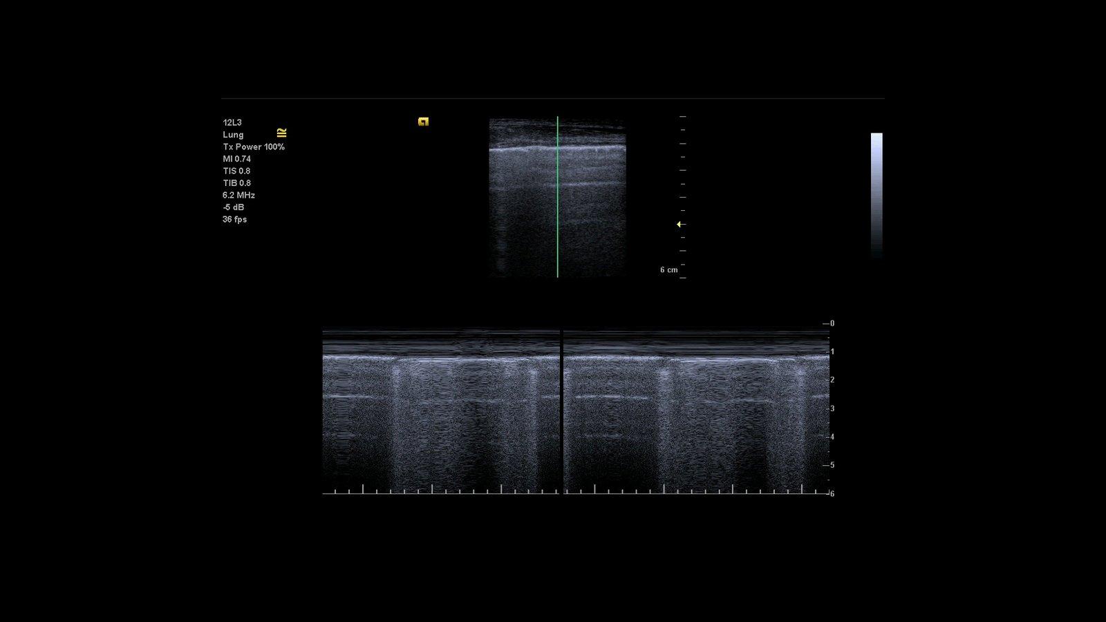 White Paper: Lung Ultrasound in Patients with Coronavirus COVID-19