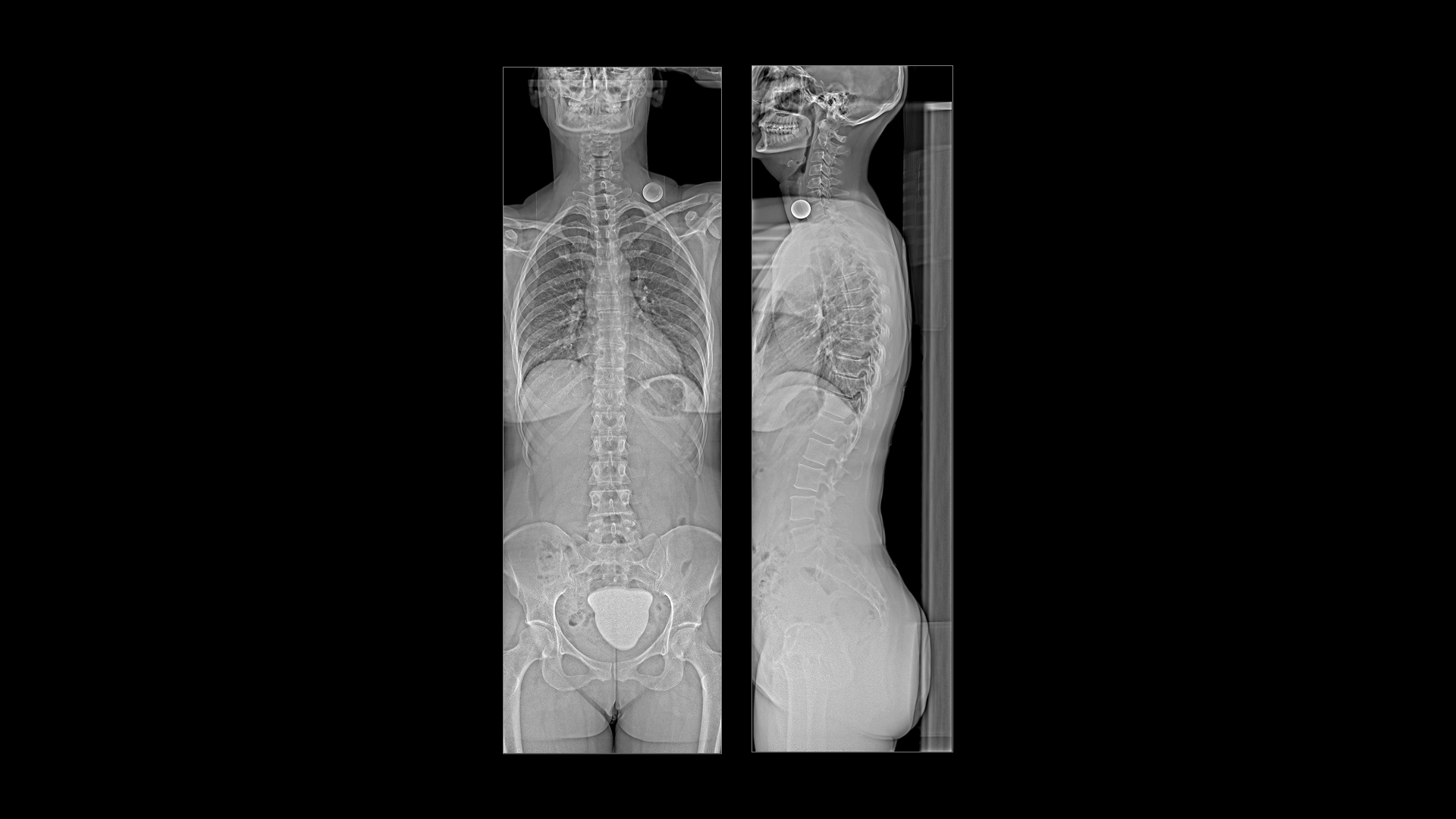 Twin Robotic X-ray scanner – Multitom Rax