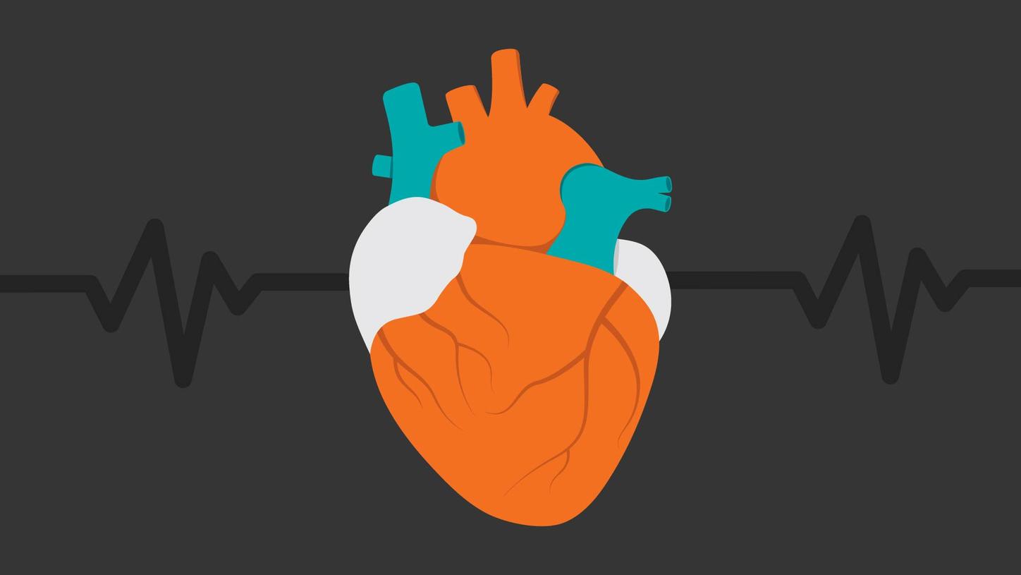Coronary artery disease