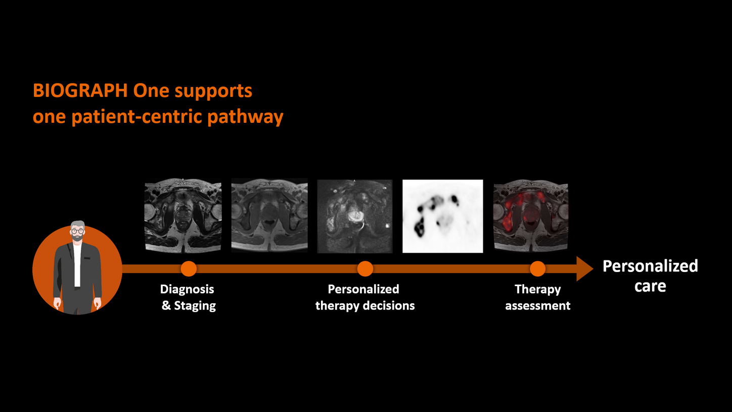 siemens-healthineers_DI-MR_BIOGRAPH-One_patient_pathway