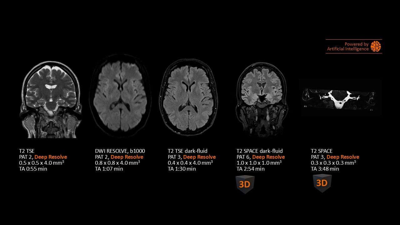 MAGNETOM Flow Head-Neuro clinical case