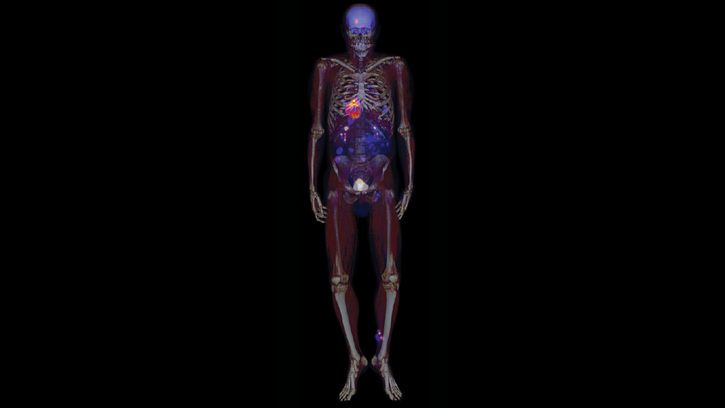 Clinical scan of the human skeleton (frontview) via Biograph mCT Flow