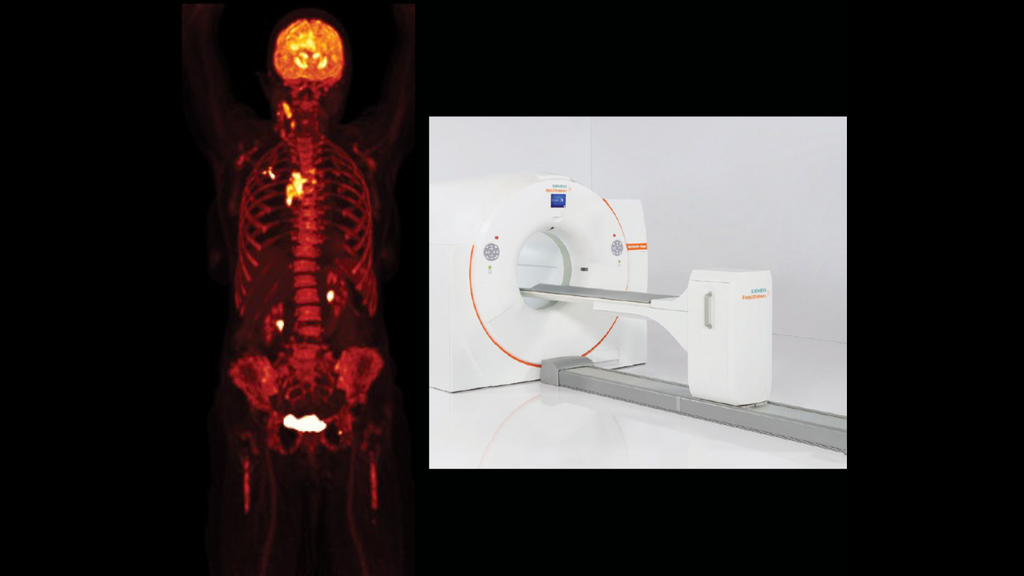 A turning point in medicine: the invention of PET/CT - Siemens ...