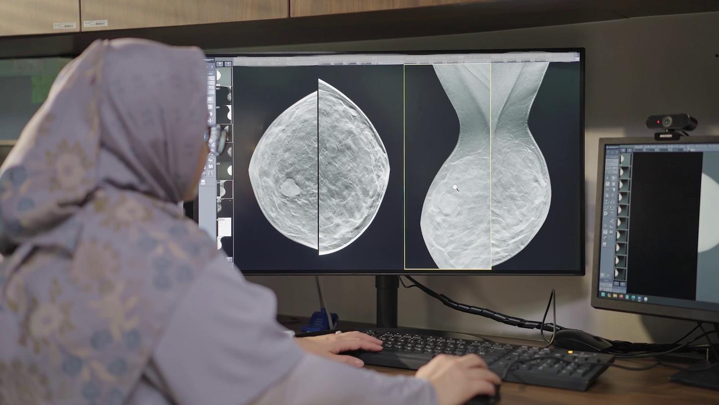 Radiologist in front of a screen