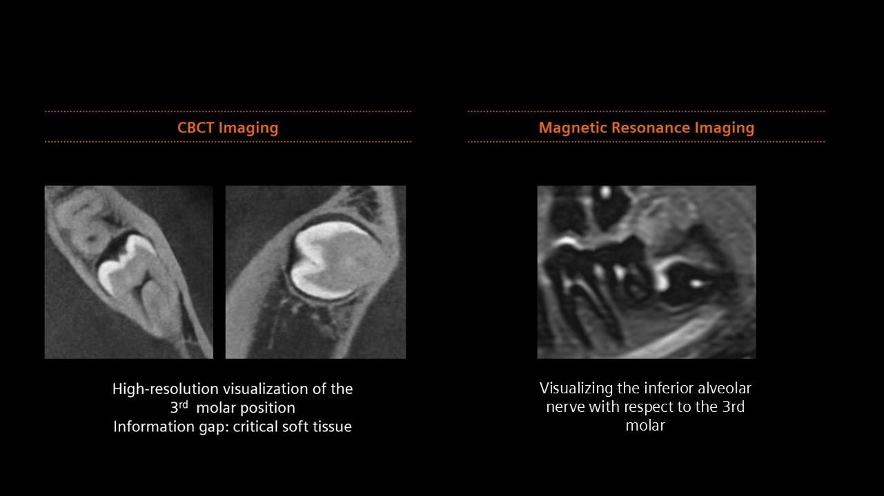 clinical image