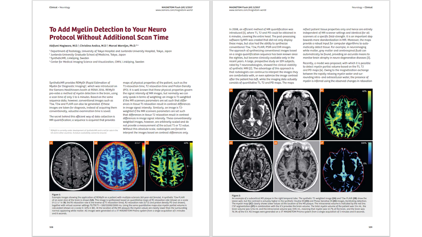 siemens-healthineers_Magnetomworld_Add-Myelin-Detection