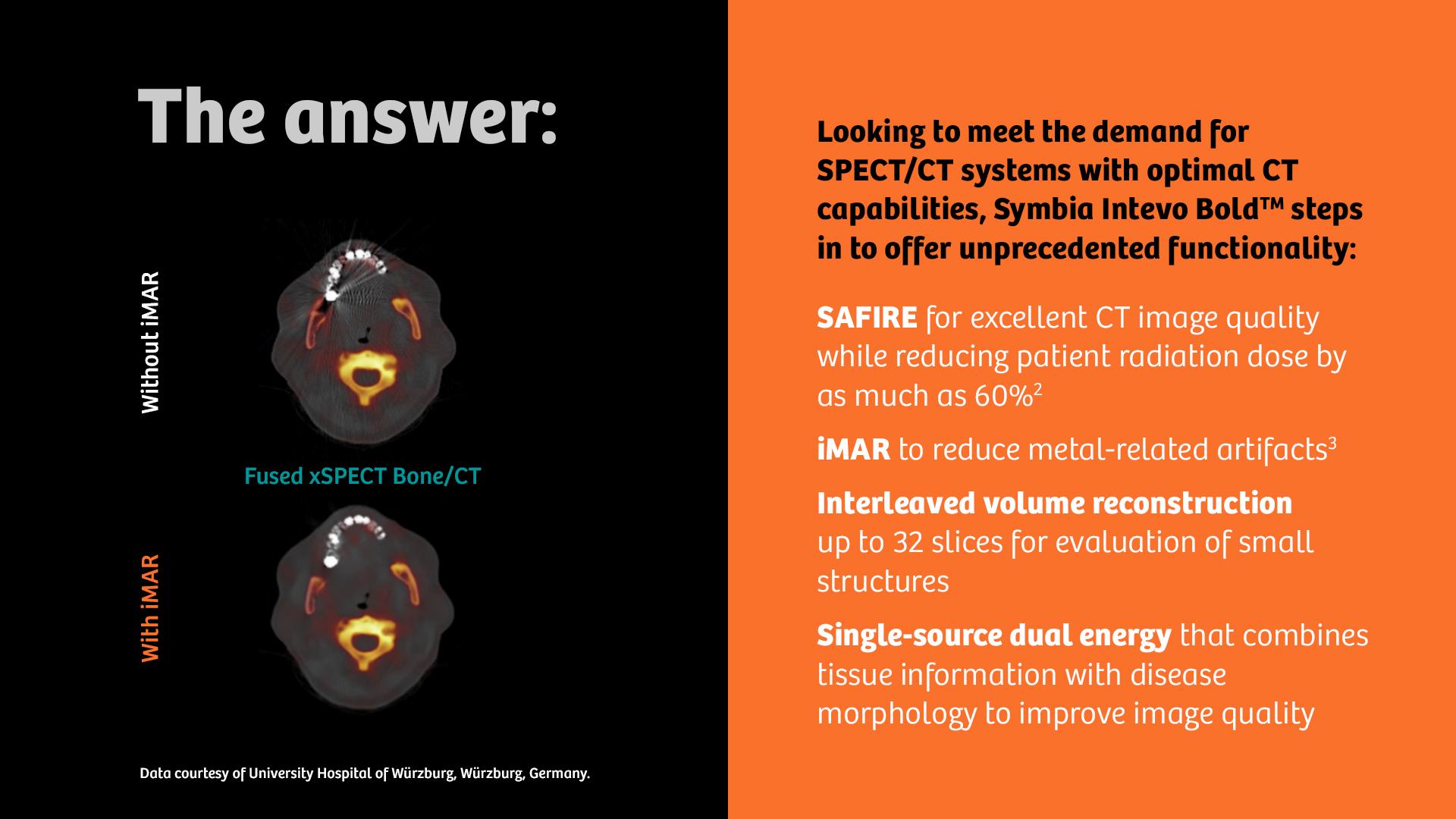 Moving SPECT/CT forward - Siemens Healthineers USA