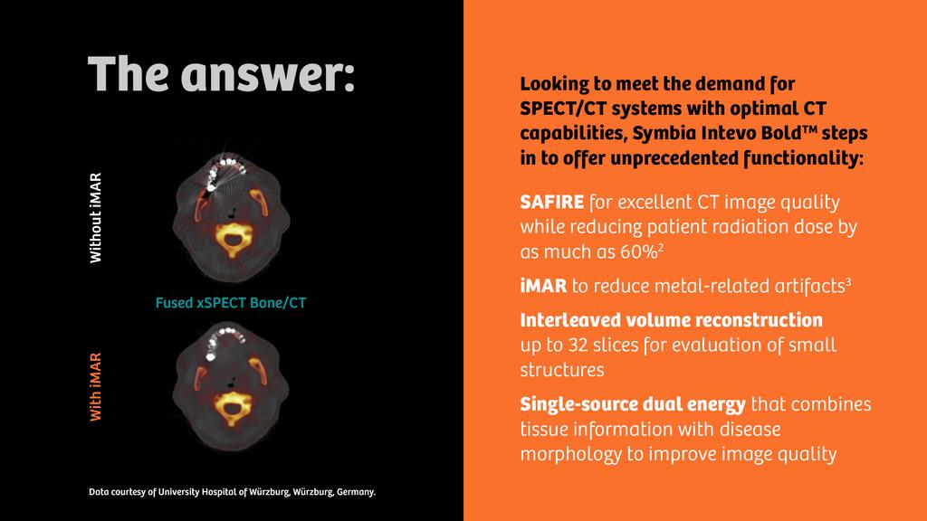 Moving SPECT/CT forward - Siemens Healthineers USA