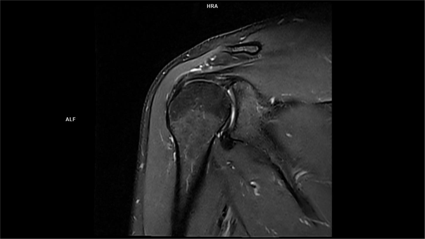 Coronal PD FS DR Sharp Lumina