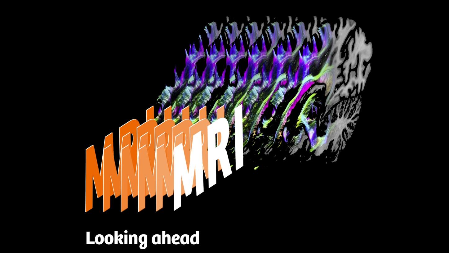 MRI is the gold standard of imaging diagnostics in many medical fields.