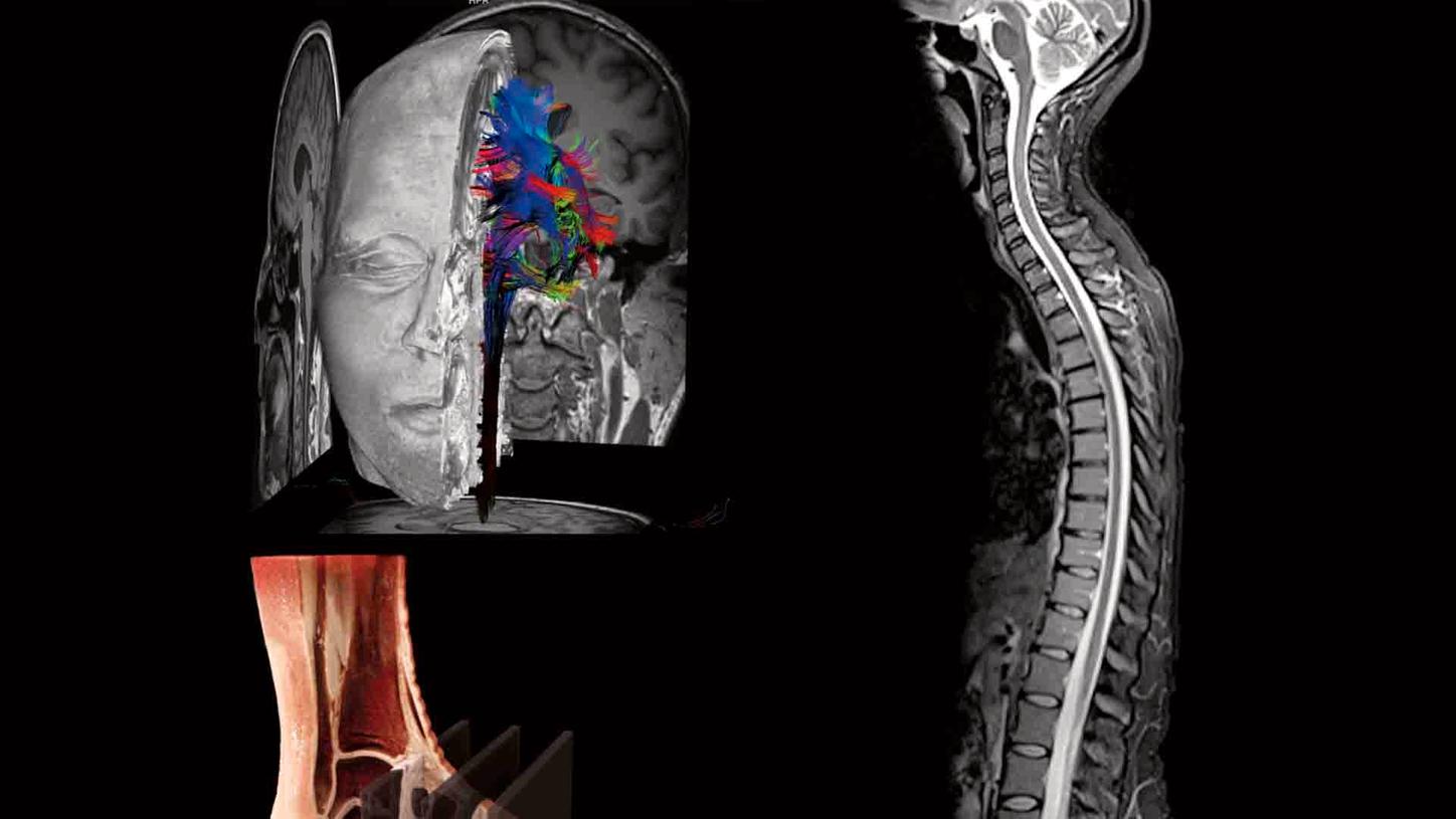 MR Neuroradiological and Musculoskeletal Imaging