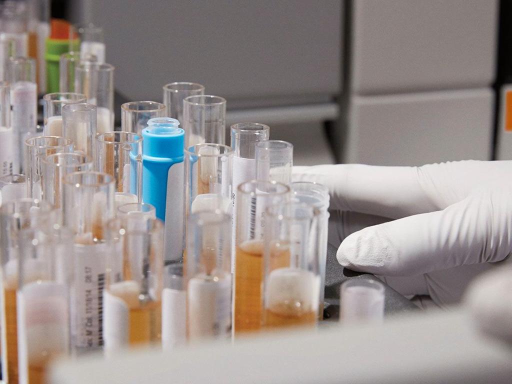 Results from an operational comparison study for clinical chemistry and ...