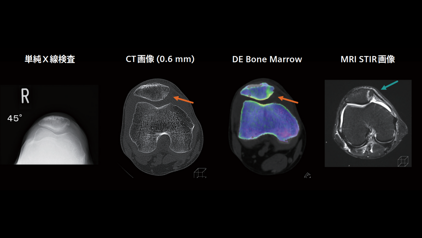JP-CT-Pro.Pulse_CaseRport_vol.2-2