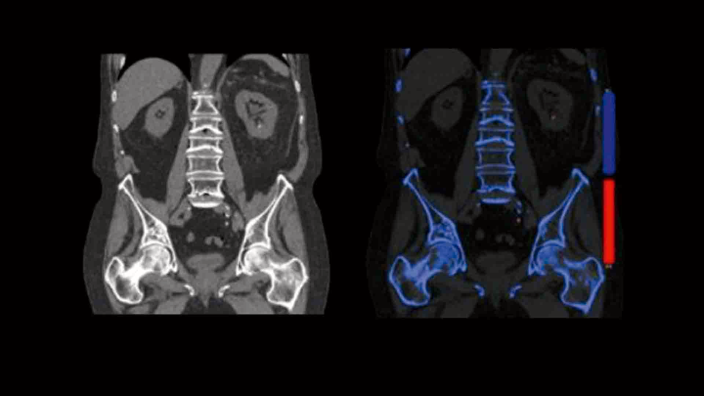 Application Training for Computed Tomography - Siemens Healthineers