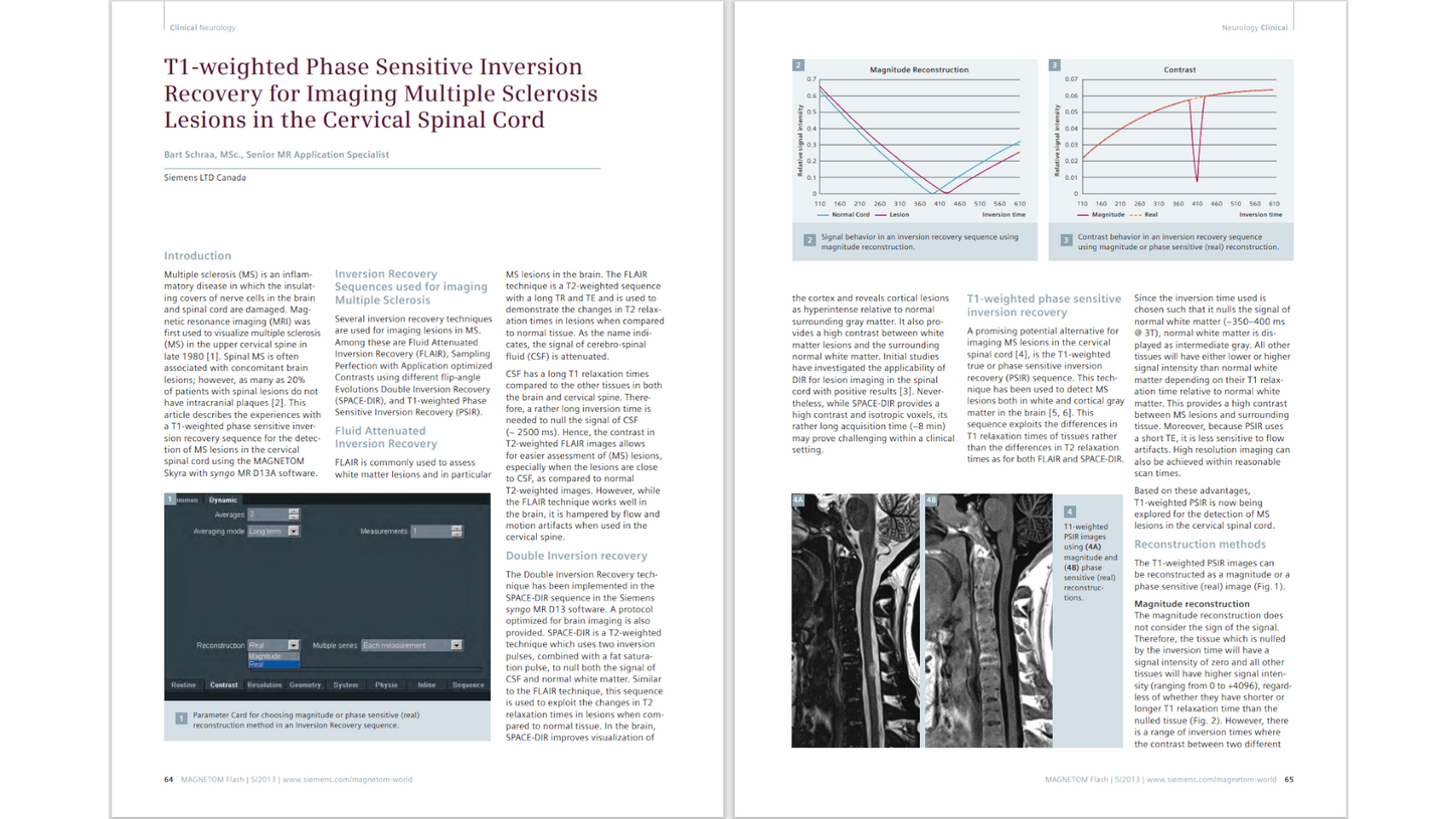 siemens-healthineers_Magnetomworld_Phase-Sensitive-Inversion-Recovery