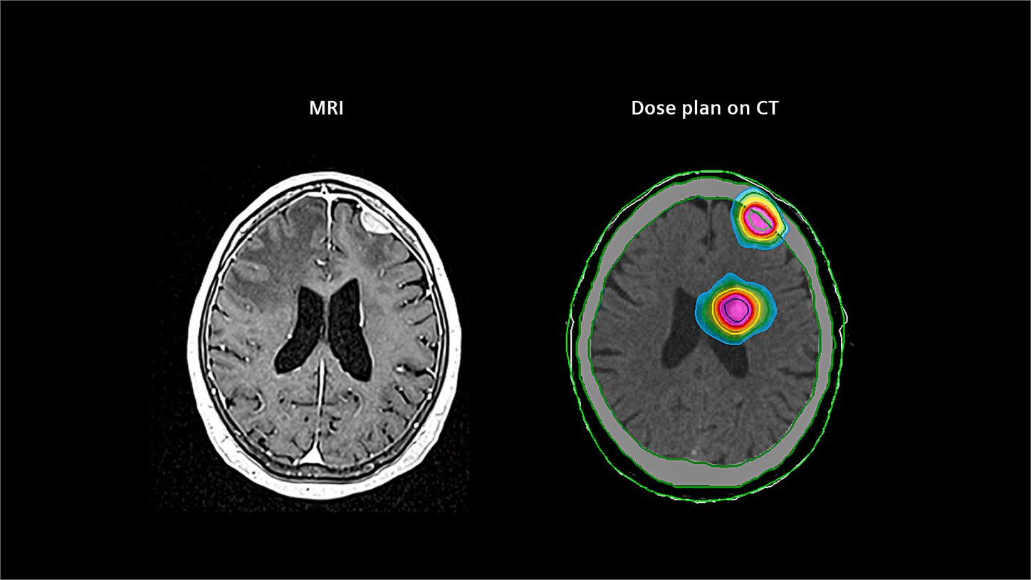 High-resolution MRI