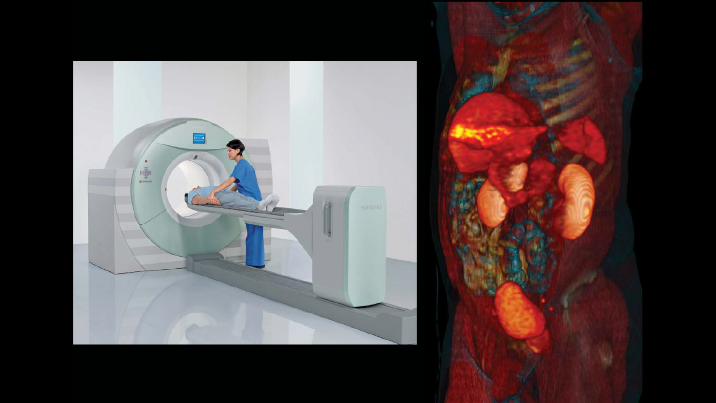 left image: hospital staff guiding patient through Biograph mCT PET/CT Scanner - right image: clinical image/scan