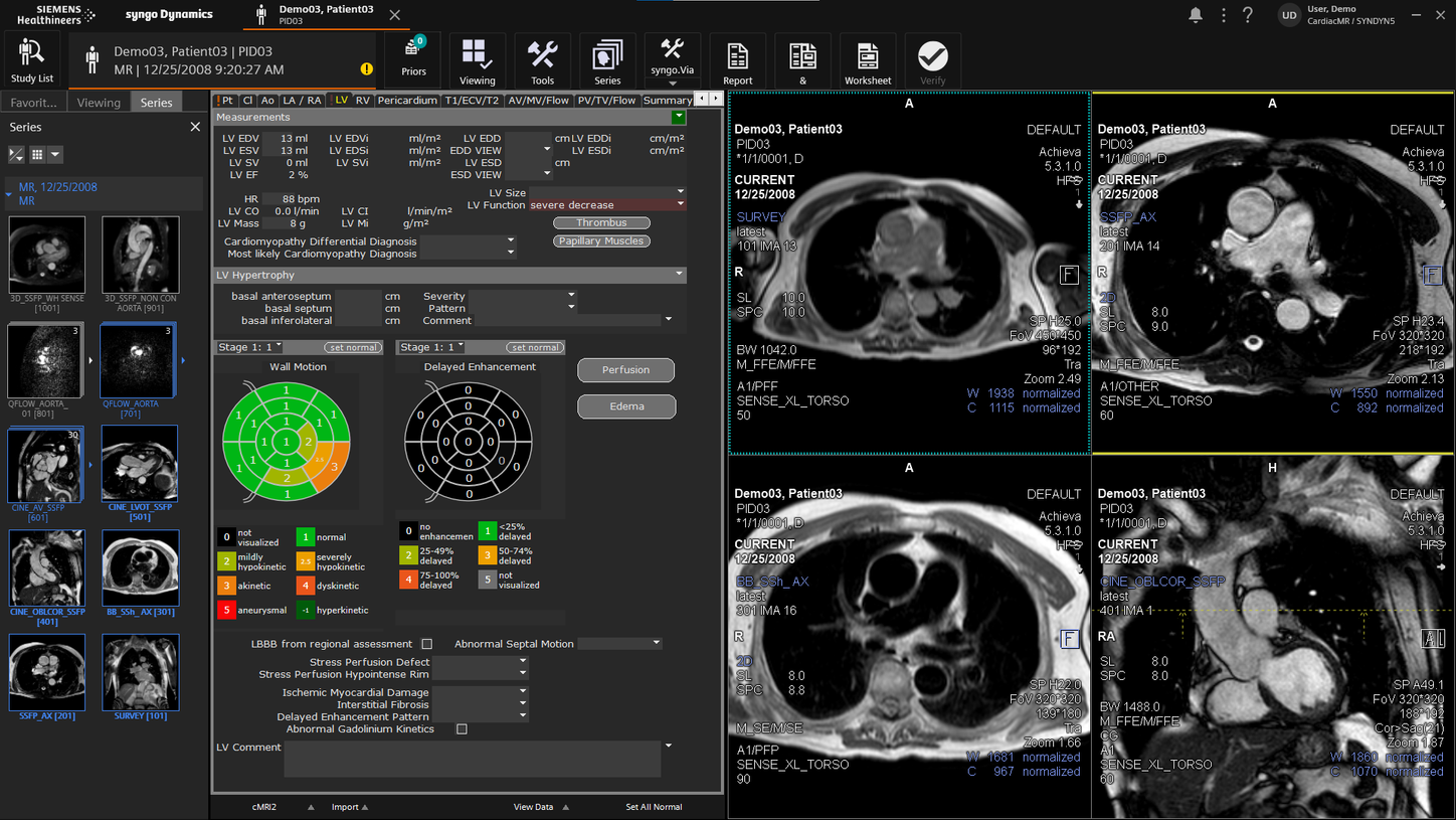 syngo Dynamics Multi Modality Reporting screenshot