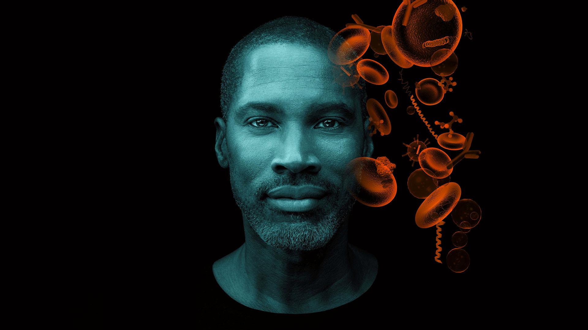 Evaluating MGUS with Free Light Chain Assays in Clinical Practice