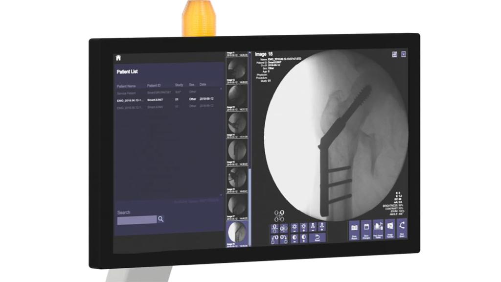 モバイルCアーム装置 Cios Fit FD - Siemens Healthineers Japan