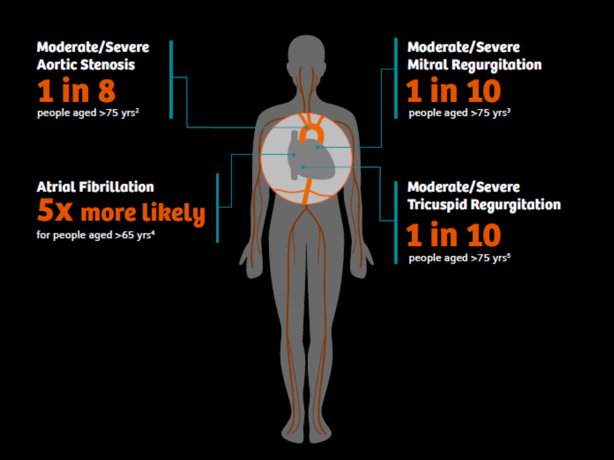 Infographic of Structural heart diseases are on the rise