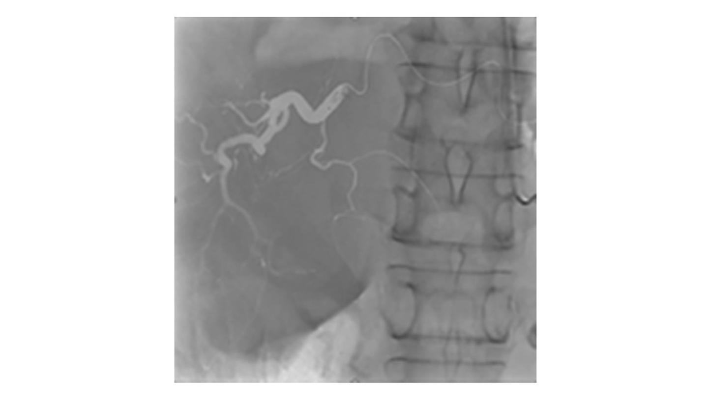OPTIQ AI Extended Overlay Ref image