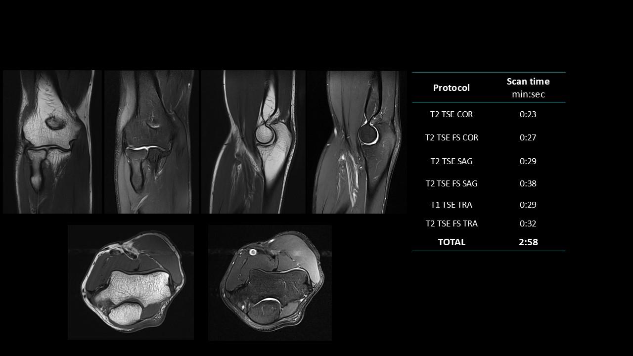 siemens-healthineers_magnetomworld_Elbow-rountine