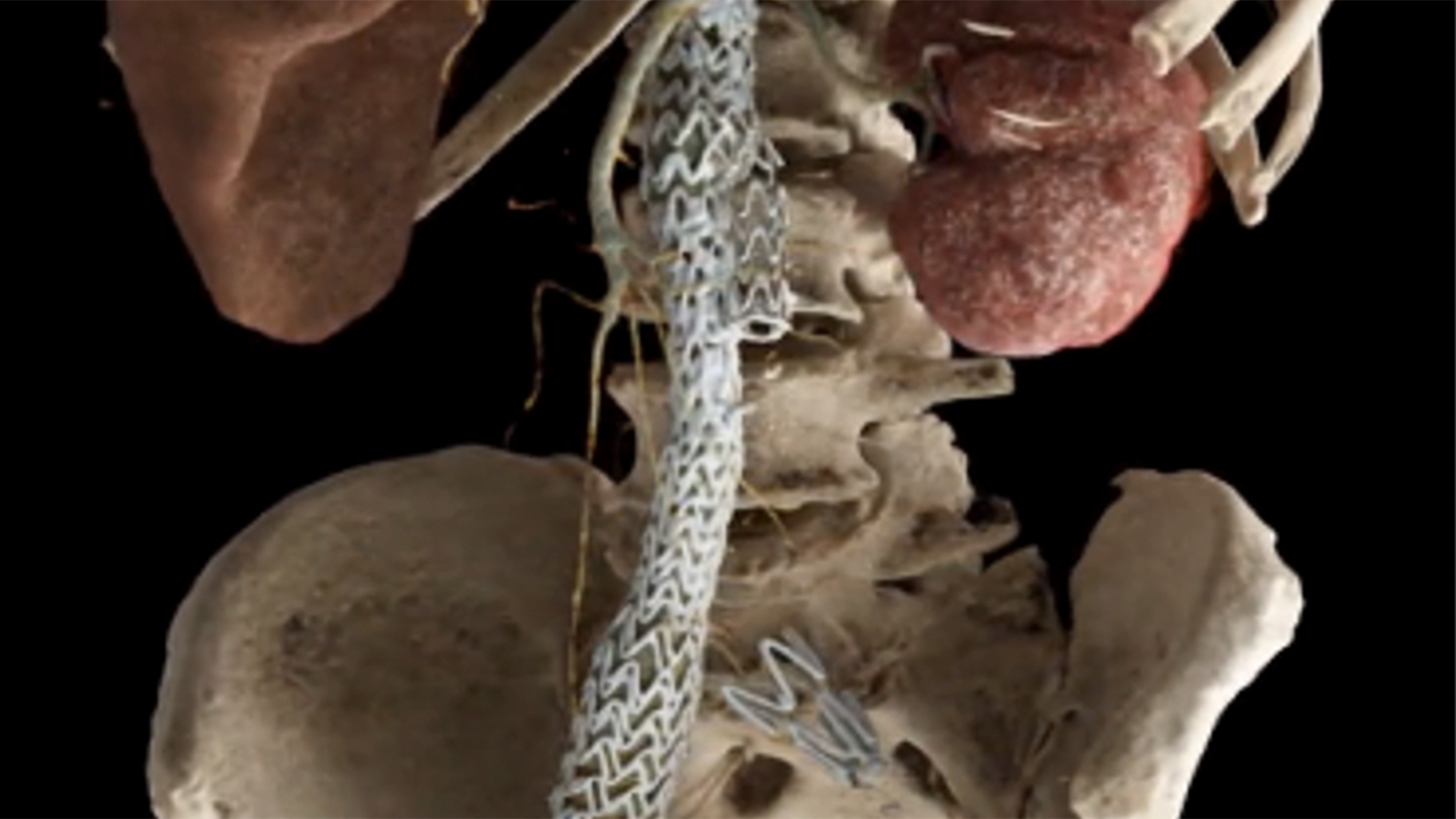 Benefits of AV and AI solutions in radiology