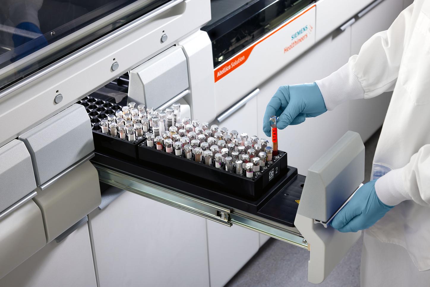 Analist haalt bloedbuis uit de analyzer