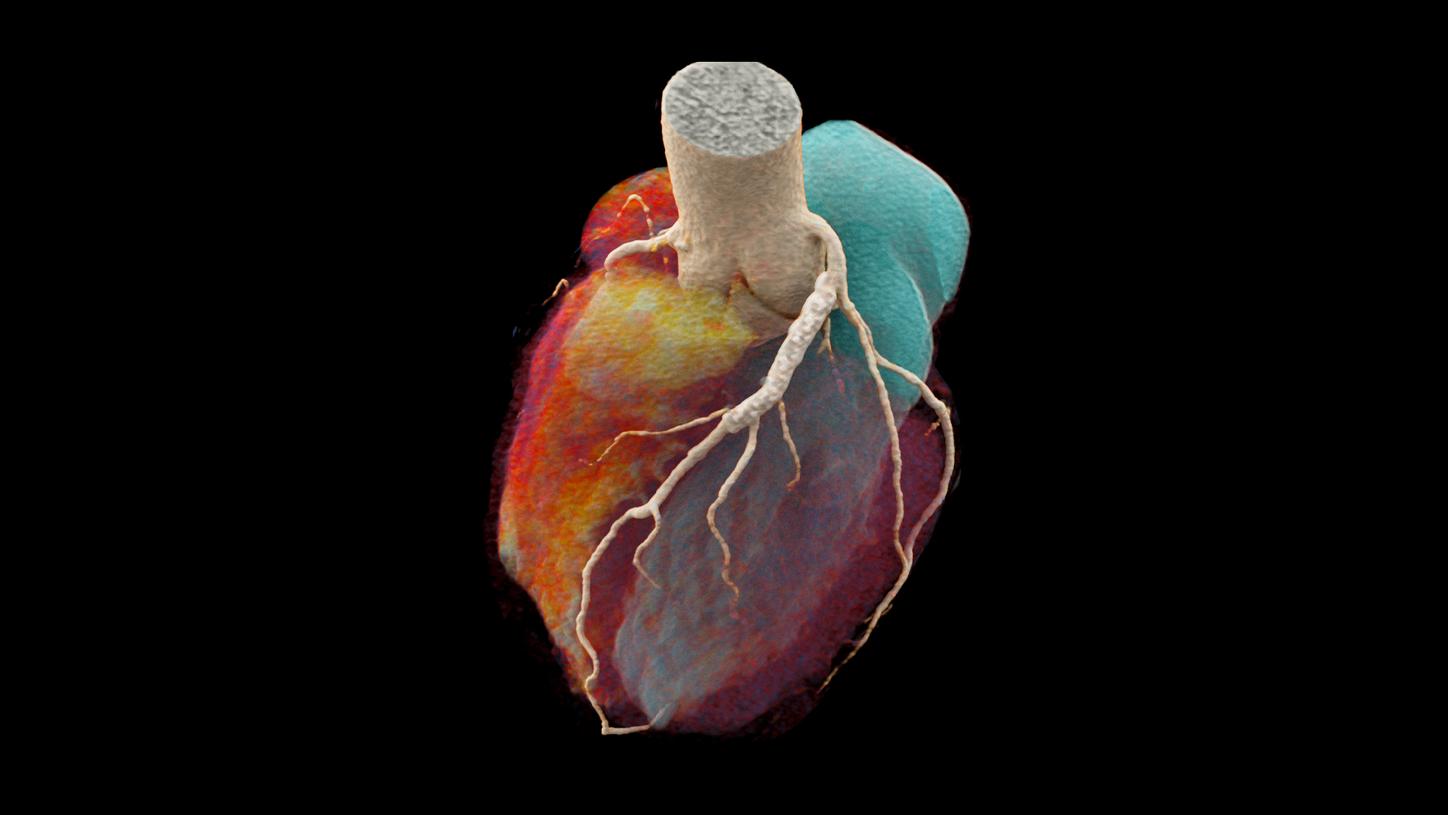 img portafolio prod serv cardiologia