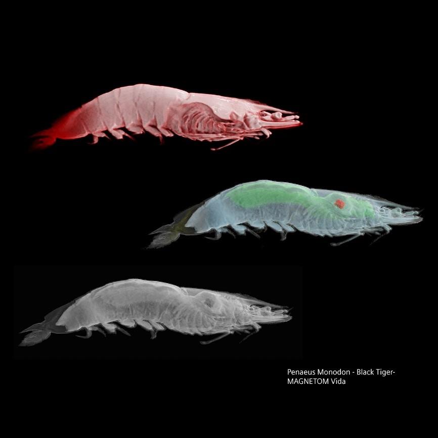 Siemens-healthineers_Magnetomworld_Black-Tiger