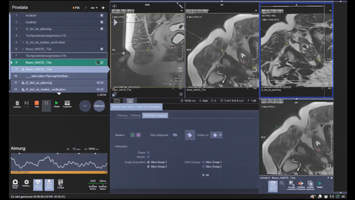 Magnetic Resonance Imaging - Clinical Software Applications - Siemens ...