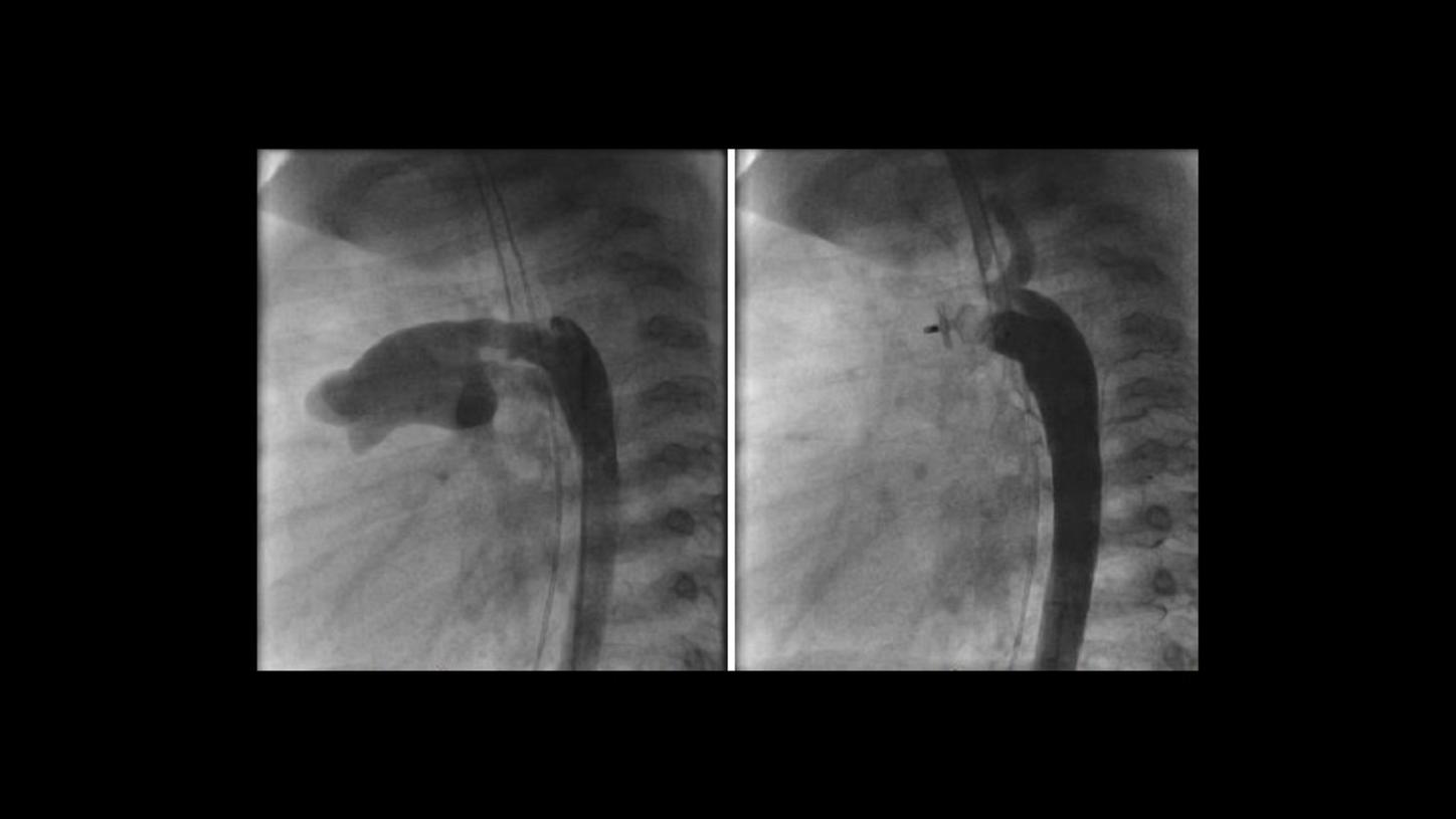 challenge of imaging small bodies