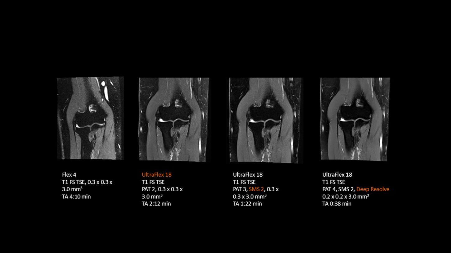 Clincial images (elbow) from MAGNETOM Aera