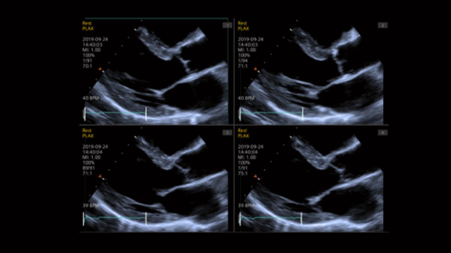 Comprehensive and flexible stress echo package