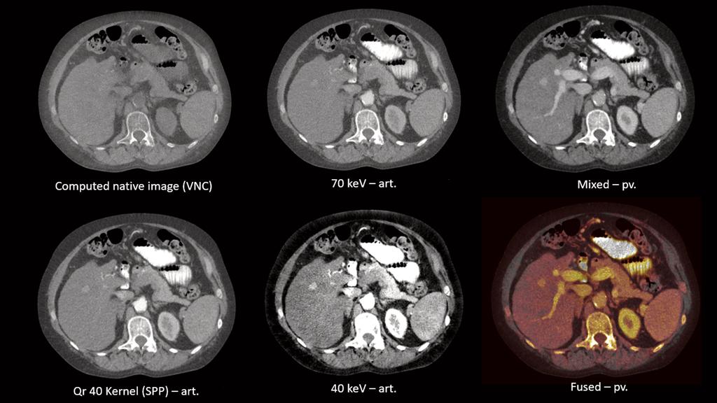 The Siemens Healthineers CT Imaging Chain - Siemens Healthineers