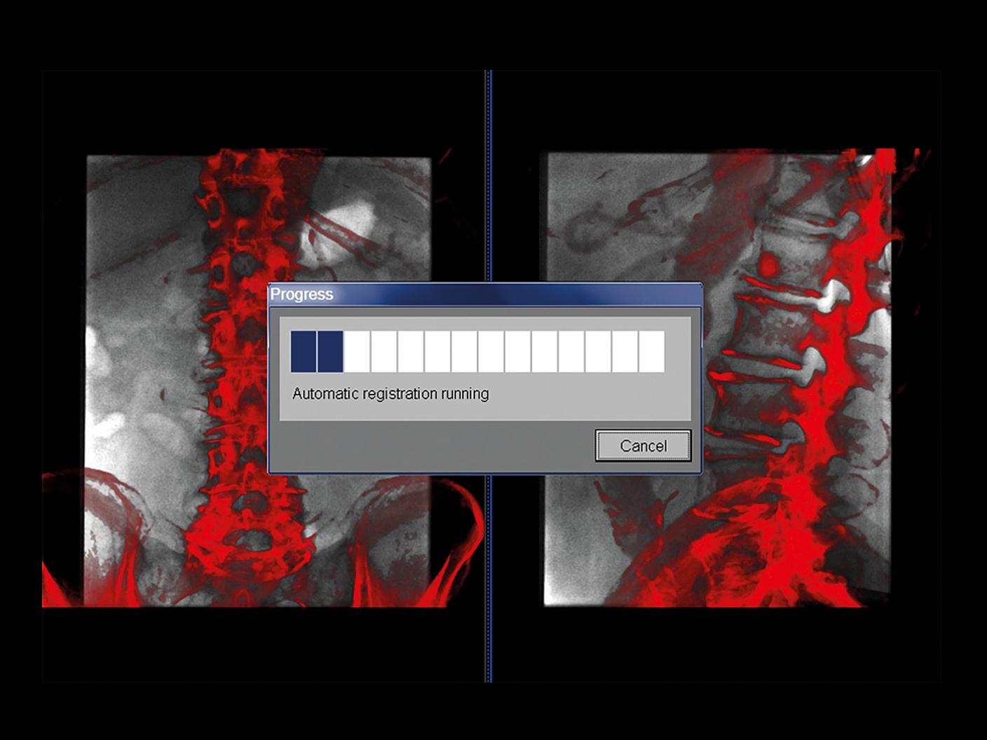 Fast registration for fusion imaging